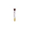 Vacutainer SST Blood Collection Tube with Transport Tube Clot Activator RedGray 75 mL 100Package
